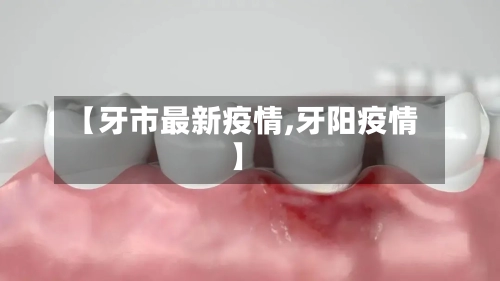 【牙市最新疫情,牙阳疫情】-第2张图片