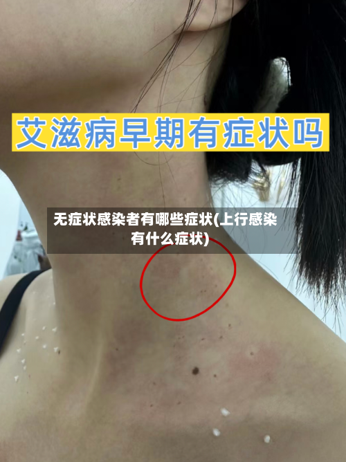 无症状感染者有哪些症状(上行感染有什么症状)-第1张图片