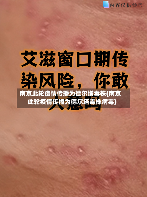 南京此轮疫情传播为德尔塔毒株(南京此轮疫情传播为德尔塔毒株病毒)-第2张图片